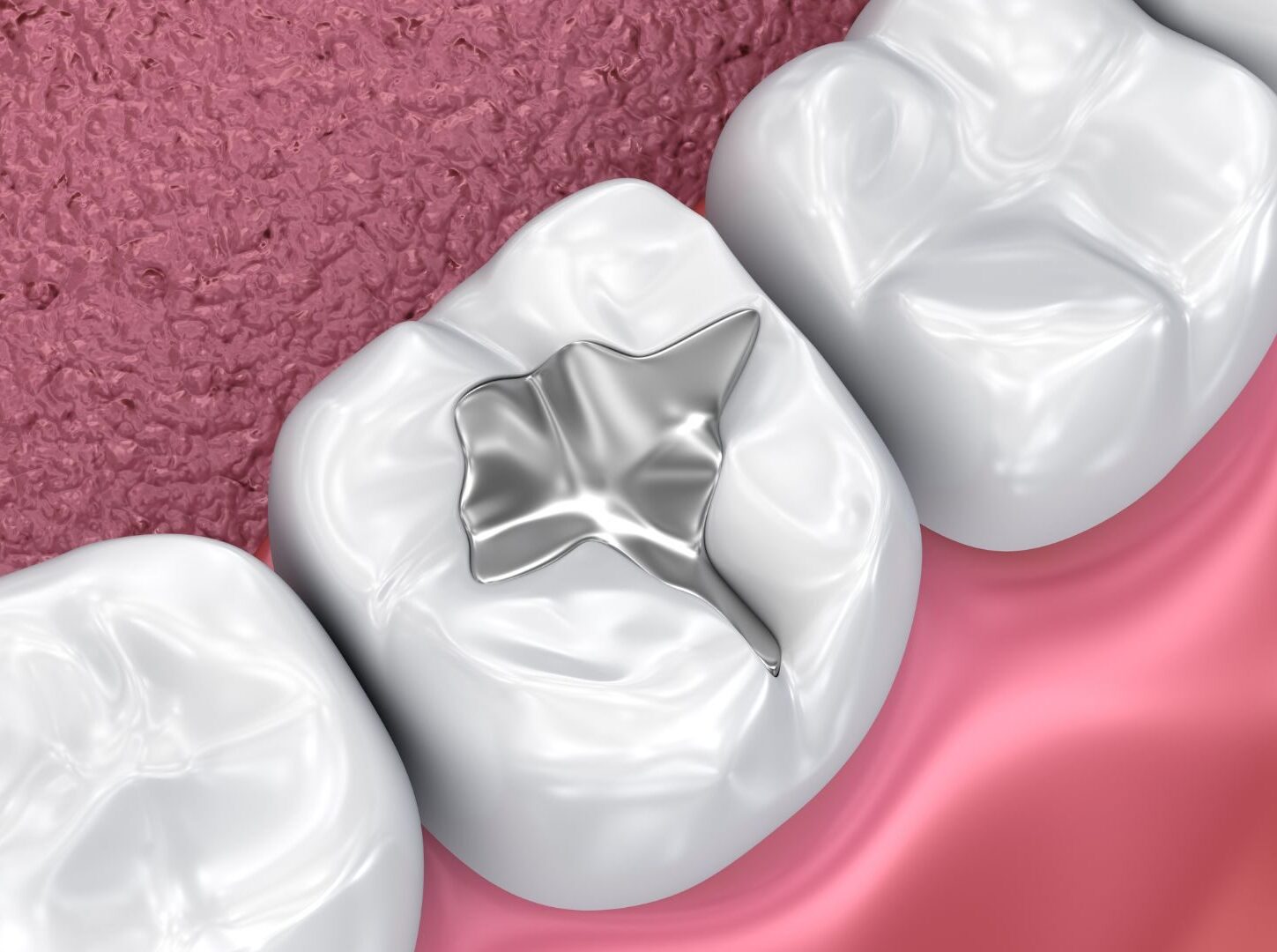 Endodoncia en Sevilla