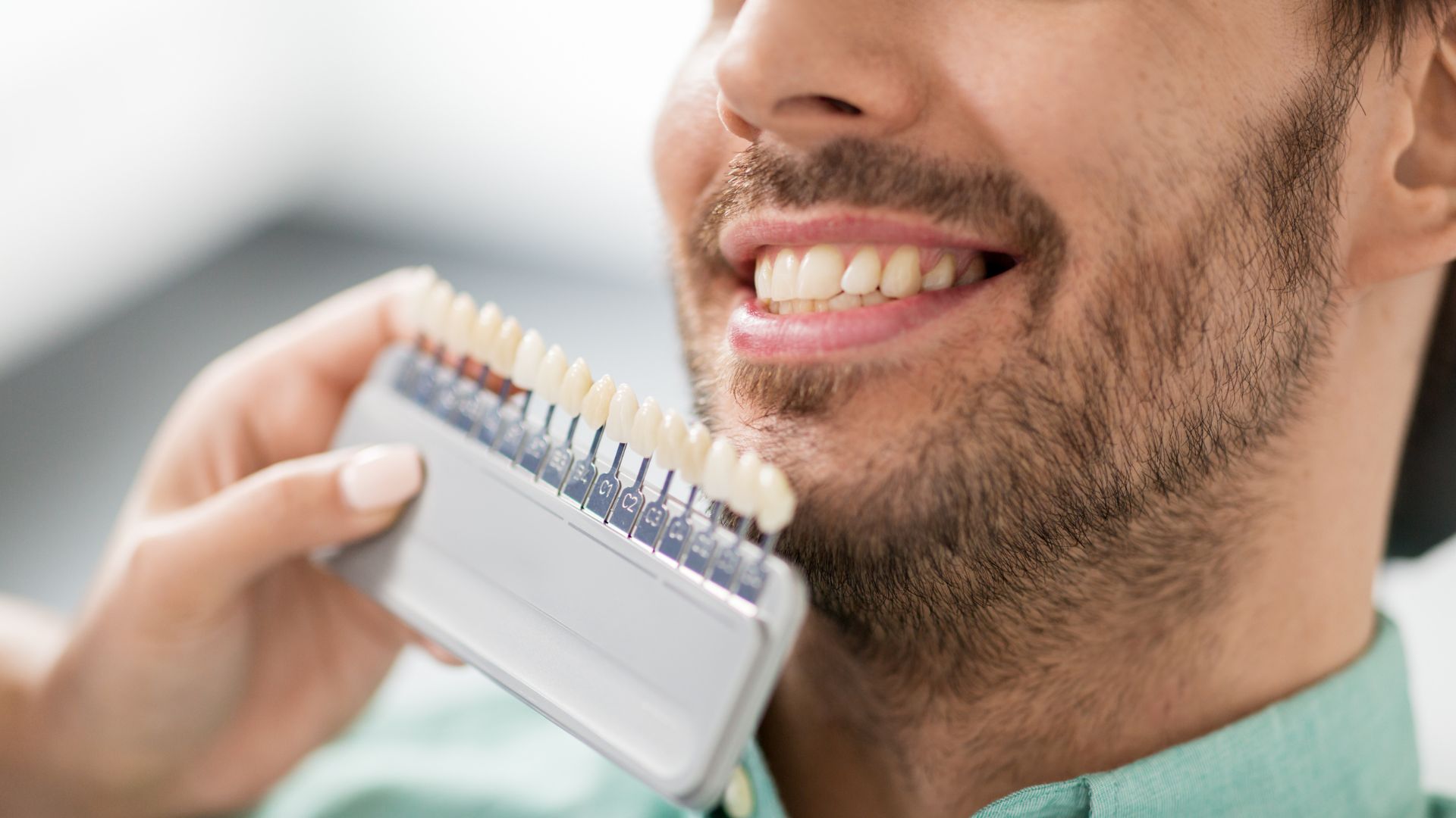 Estética dental - Carillas