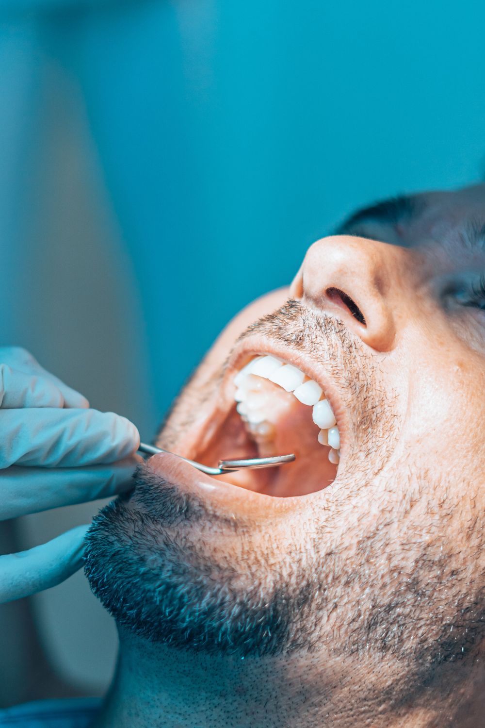 Periodoncia - Revisón Grupoden Dra Lozano